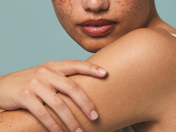 Tough on Acne, Soft on Skin